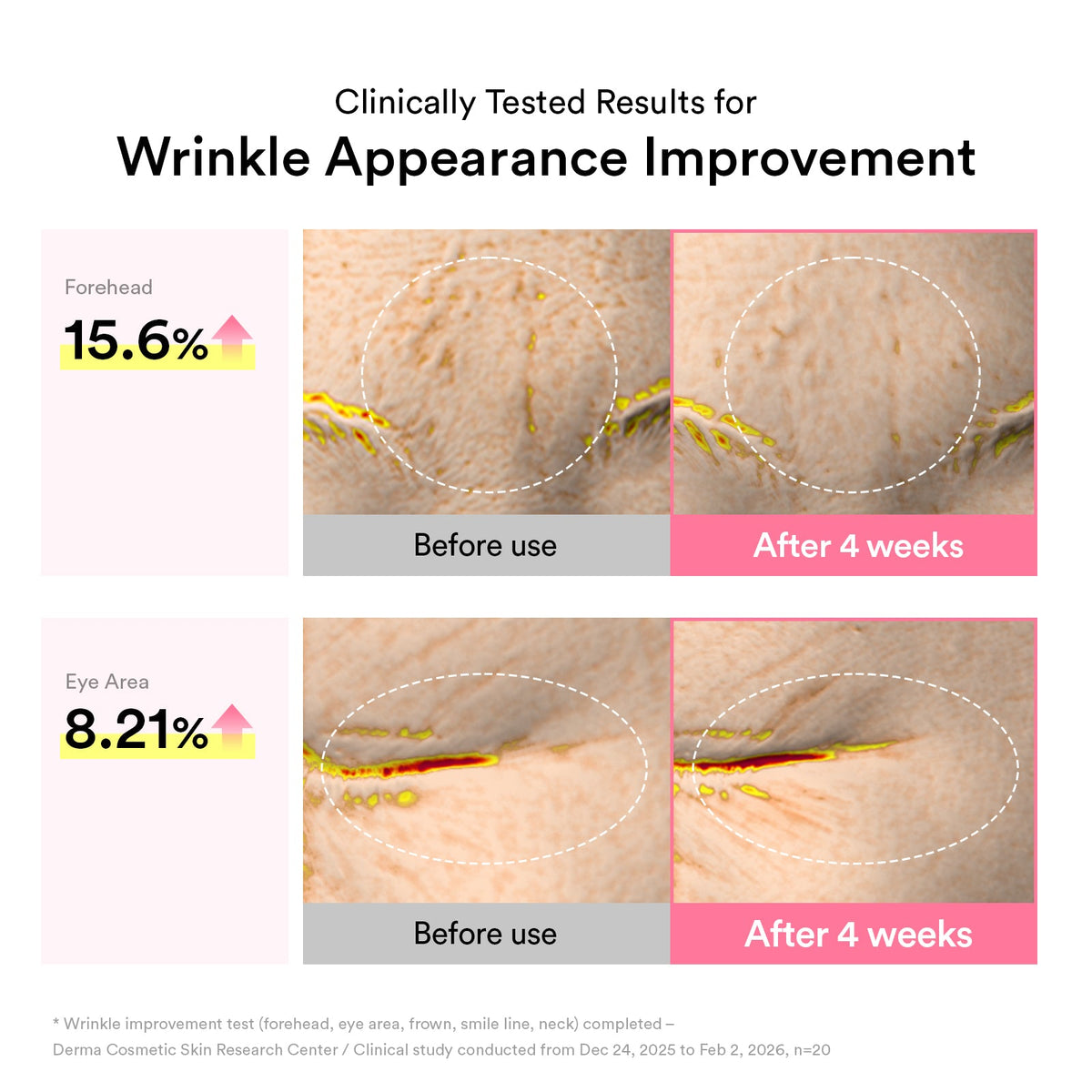 Clinically tested wrinkle appearance improvement before and after