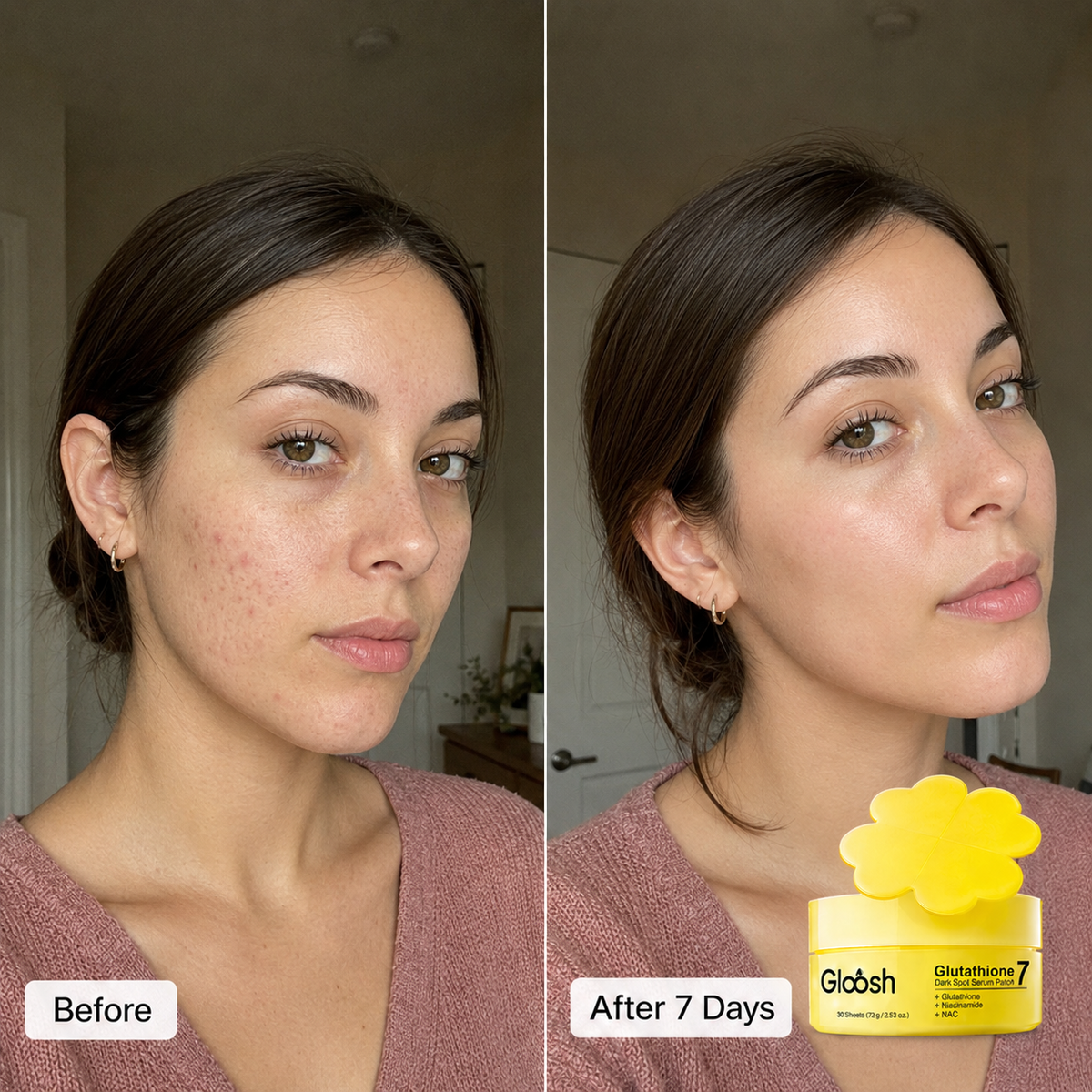 Glutathione Patches - Visibly Fade Dark Spots in Just 7 Days