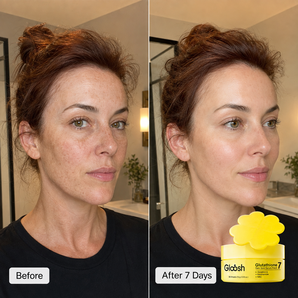 Glutathione Patches - Visibly Fade Dark Spots in Just 7 Days