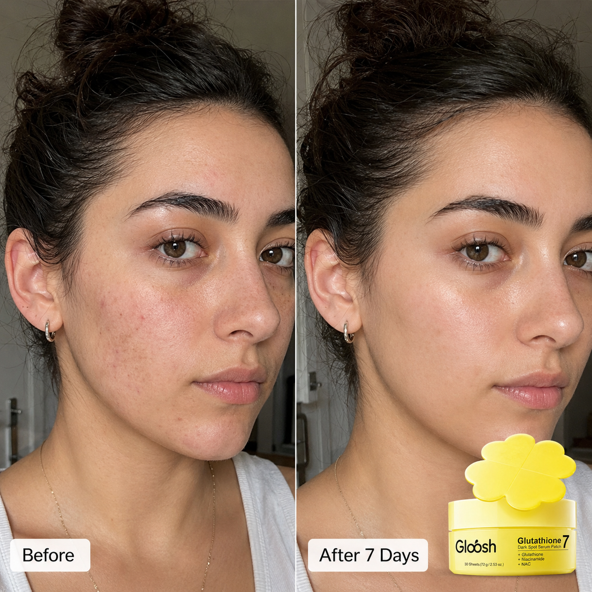 Glutathione Patches - Visibly Fade Dark Spots in Just 7 Days