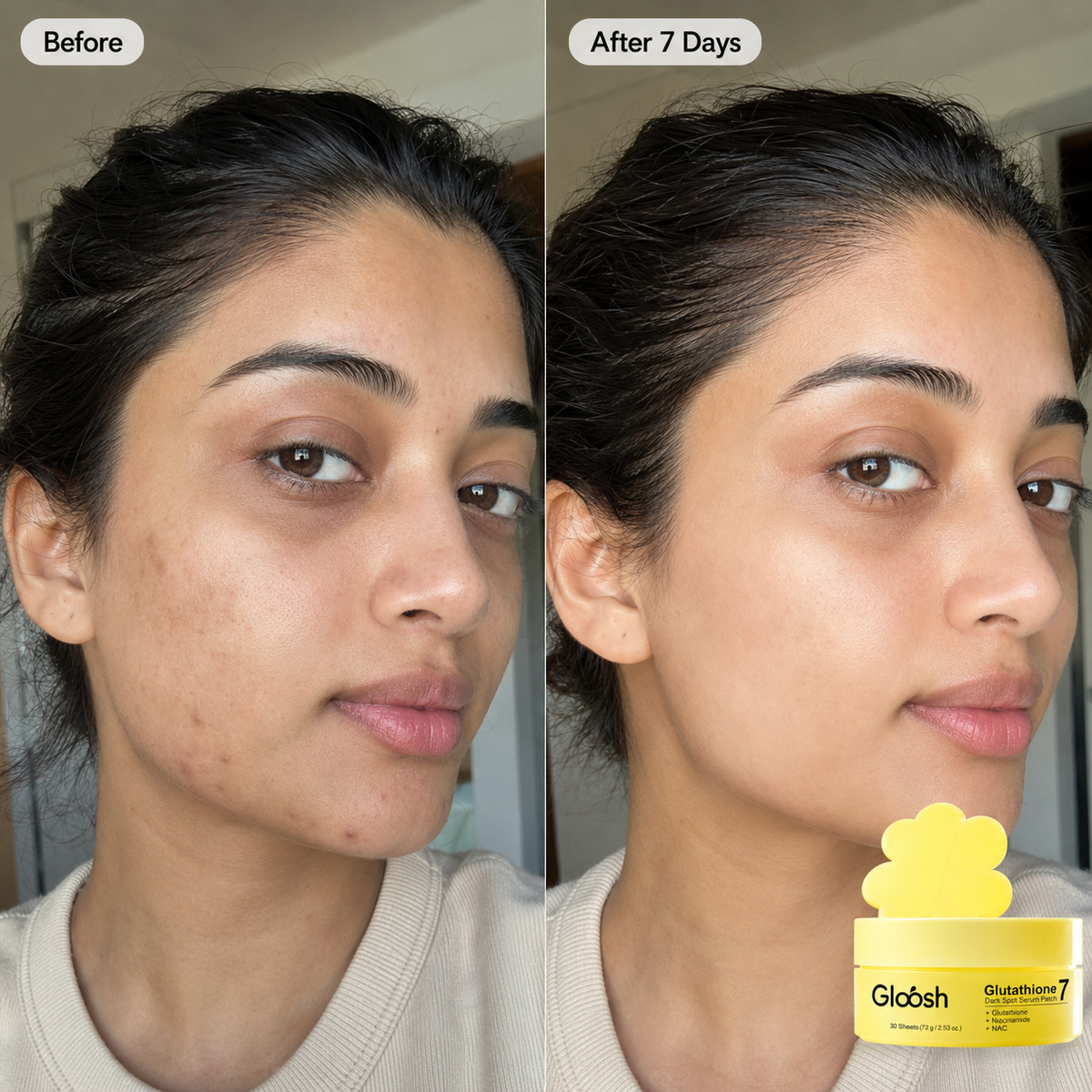 Glutathione Patches - Visibly Fade Dark Spots in Just 7 Days