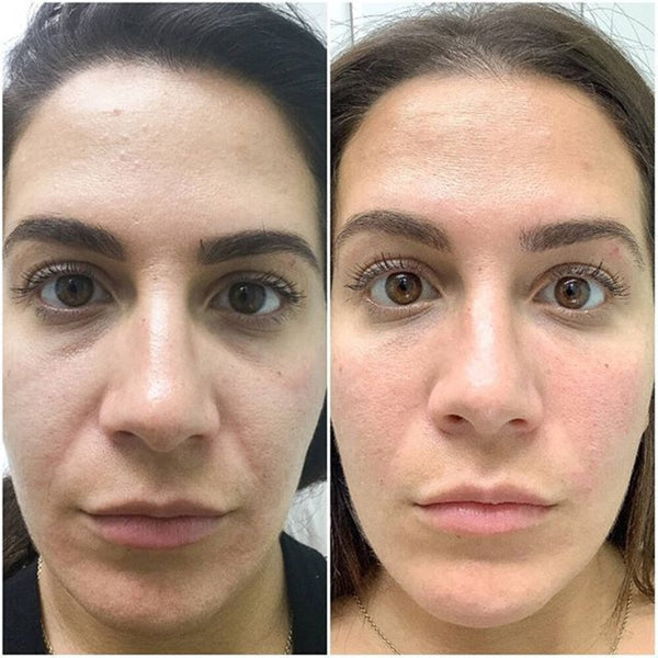 Elena M., 34