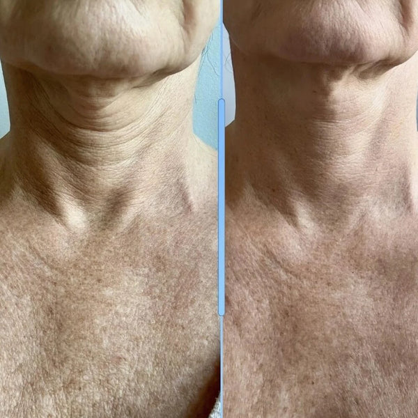 Denise R., 58